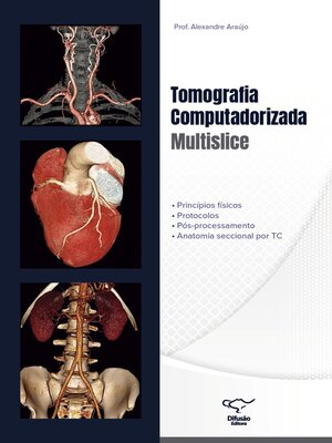 cover image of Tomografia Computadorizada Multislice